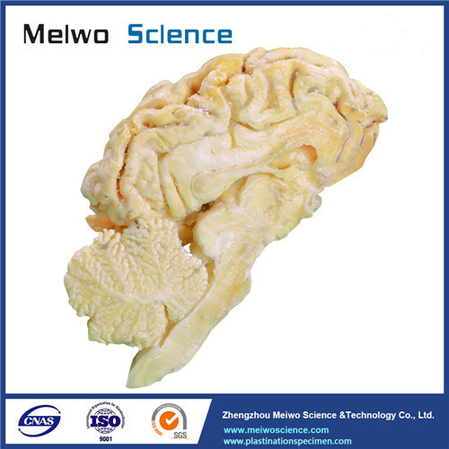 Brain hemisphere of sheep plastinated specimen