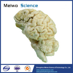 Brain hemisphere of sheep plastinated specimen