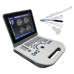 laptop ultrasound diagnostic equipment