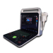 Portable color doppler ultrasound diagnostic system