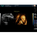 Portable color doppler ultrasound diagnostic system