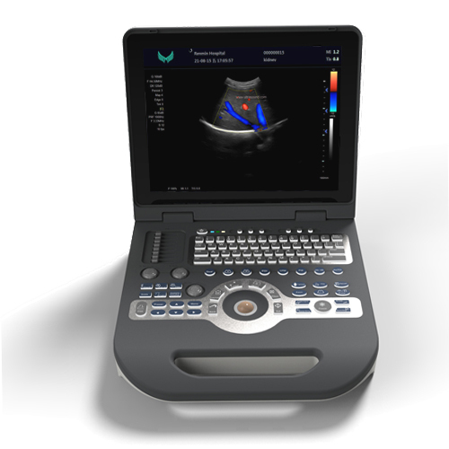 laptop Color Doppler Ultrasound Diagnostic Scanner Equipment