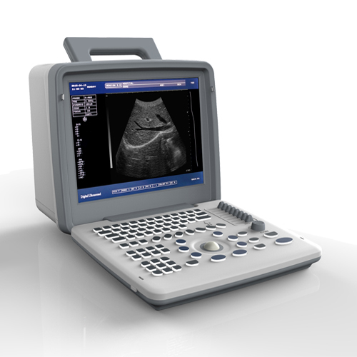 Full digital portable black white ultrasound diagnostic equipment