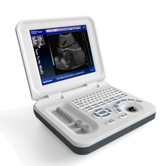 Portable laptop full digital ultrasound machine.10.4 inch with battery