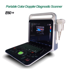 Portable Color Doppler Ultrasound Diagnostic Equipment.High-grade Ultrasound Machine