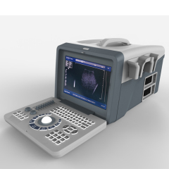 portable 10 inch full digital ultrasound scanner