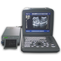 12 inch portable full digital black and white ultrasound diagnostic machine