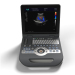 full digital laptopcolor doppler ultrasound diagnostic scanner