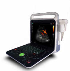 Full digital color doppler ultrasonic system.3D Real -time imaging