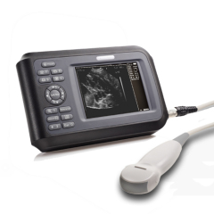 Full digital hand held black and white ultrasound machine