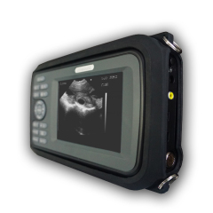 Handheld full digtal black and white ultrasound scanner