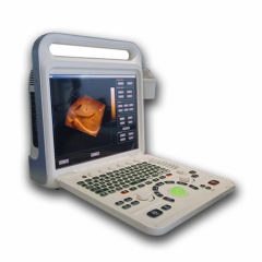 3D Full Digital Color Doppler Ultrasonic Diagnosiitc System