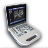 light and thin laptop black and white ultrasound diagnostic equipment