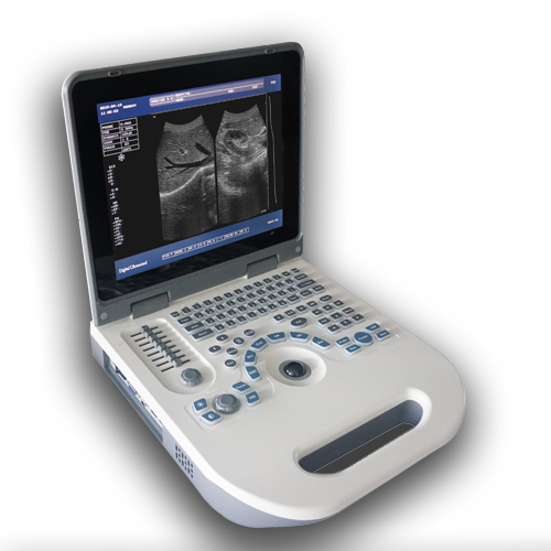 laptop light and thin black and white ultrasound diagnostic scanner