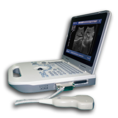 light and thin laptop black and white ultrasound diagnostic equipment