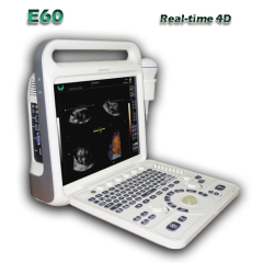 Portable Color Doppler Ultrasound 4D Diagnostic System