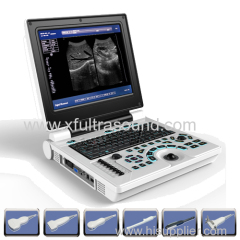 Portable Ultrasound Scanner.12 inch with battery