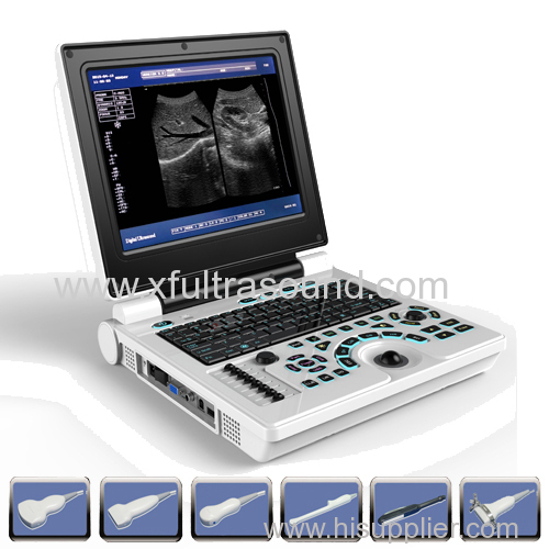High voltage probe black&white ultrasound scanner