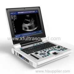 Portable Ultrasound Scanner.12 inch with battery