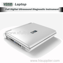 Veterinary laptop full digital ultrasound diagnostic;pet ultrasound machine
