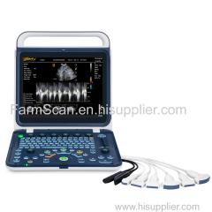 Vet Portable Color Doppler Veterinary Ultrasound Scanner