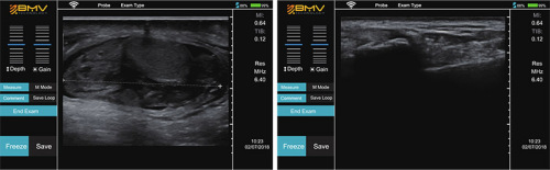 IP67 Wireless Ultrasound Scanner for Large Animal Scanning