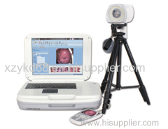 YKD-3004 Portable Digital Colposcope