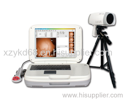 YKD-1004 Portable Infrared Breast Examination Equipment