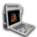 Portable Real Time 4D Scanner Ultrasound Diagnostic System