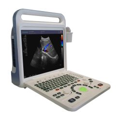 Portable Full Digital Color Doppler Ultrasound Diagnostic System