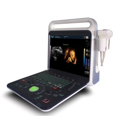 Real-time 4D imaging color ultrasonic diagnosis system