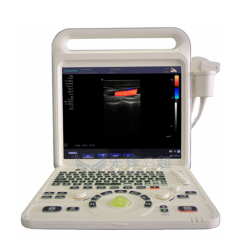 Portable Full Digital Color Doppler Ultrasound Diagnostic System