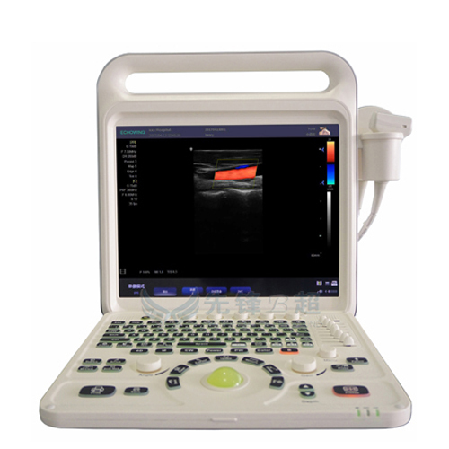 Full Digital Portable Color Doppler Ultrasonic Diagnosis System