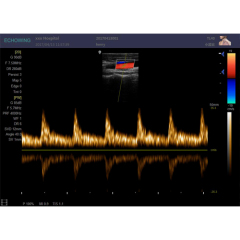 XF3600 Portable Full Digital Color Doppler Ultrasound Scaner with two probe