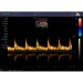 Full Digital Portable Color Doppler Ultrasonic Diagnosis System