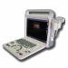 Full Digital Portable Color Doppler Ultrasonic Diagnosis System