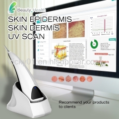 iBeier: USB connective portable skin analyzer