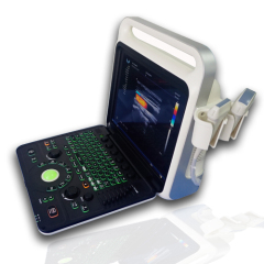Echowing80 high end color doppler ultrasound diagnostic system
