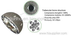 SEE Trabecular Acetabular Cup System