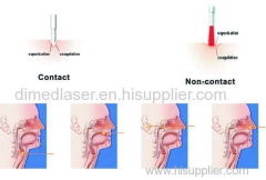 Class IV Laser Multifunctional laser surgery laser equipment ent laser for Otolaryngology