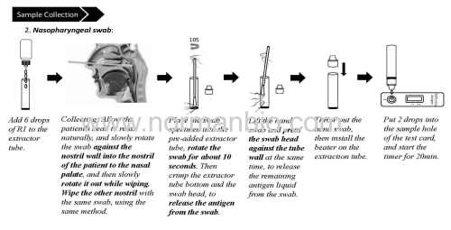 Novel Coronavirus (2019-nCoV) Antigen Testing Kit (Colloidal Gold)