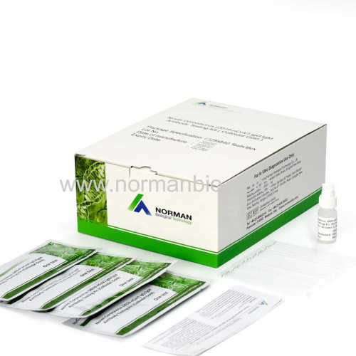 NEW ARRIVED nCov-19 diagnostics lgG/lgM Antibody Rapid Testing Kit