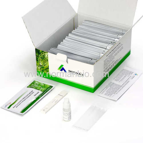 FOR LAB USE Covid-19 lgG/lgM Antibody Rapid Testing Kit