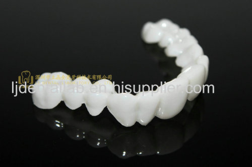 PETG clip-on-veneers dental veneers