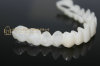 CAD/CAM resin dental clip on veneers & vacuum forming smile veneers & dental veneers