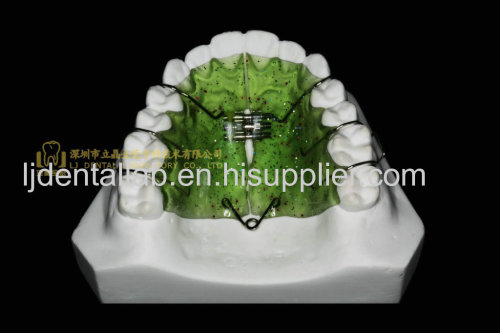 Space Expanders Palatal Expander