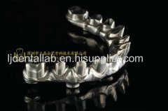 Full-arch implant bridge prosthesis & implant denture framework & implant prosthesis