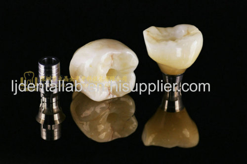 Dental implant crown & integrated abutment crown IAC & implant prosthesis