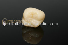 Dental crown solid zirconia crown & BruxZir crown & HT full-contour Zirconia dental crown