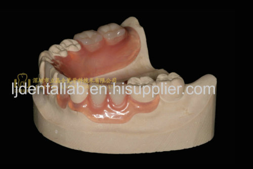 Dental valplast denture & acrylic denture & dental prosthesis